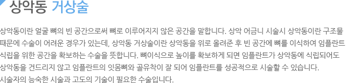 상악동 거상술